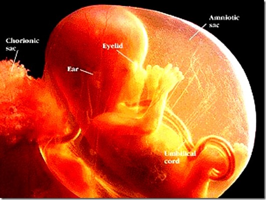 Unborn Baby 2