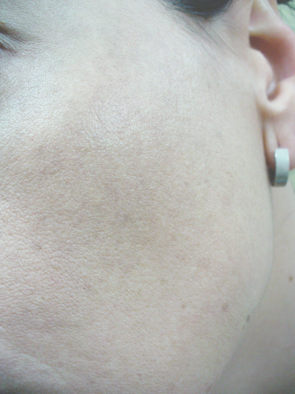 [dermablend 007[3].jpg]