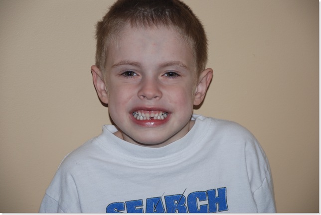 2008 Lost Tooth014