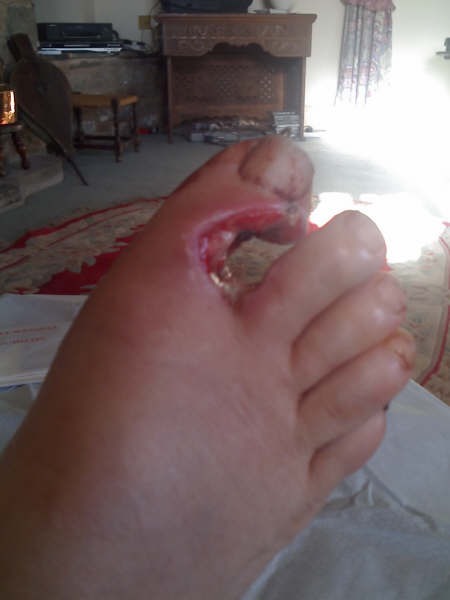 Foot Top
