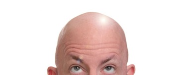 bald_head