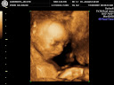 Baby Ladomato