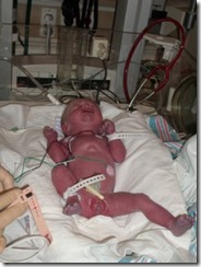 Gabrielle in her ICU Gabrielle in her ICU