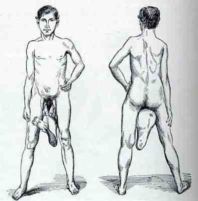 [dos santos con tres piernas y dos penes (1)[4].jpg]