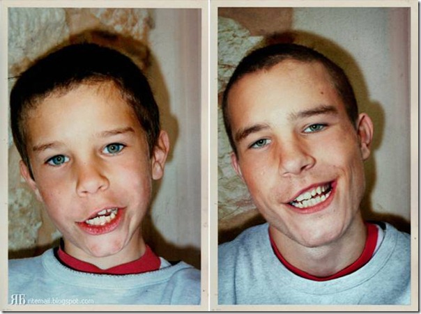 antes antes