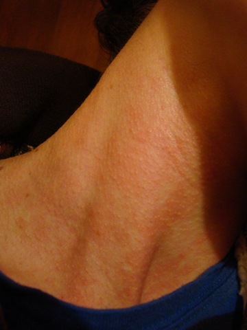 [hives[5].jpg]