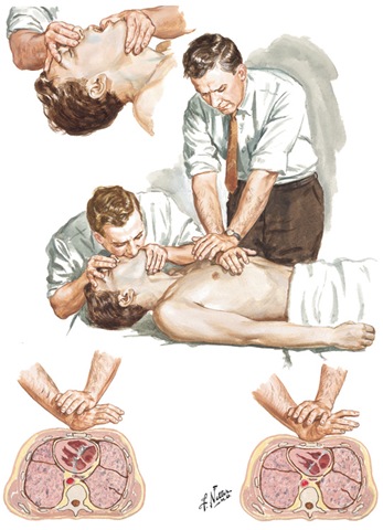 [Netter CPR 764-14152[5].jpg]
