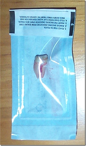 Gavins Molar