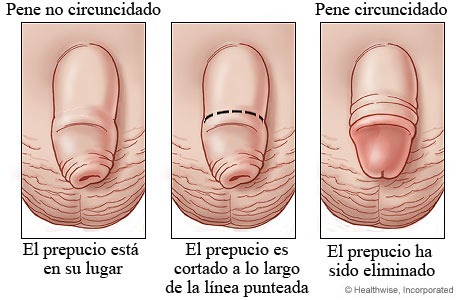 [circuncision24.jpg]