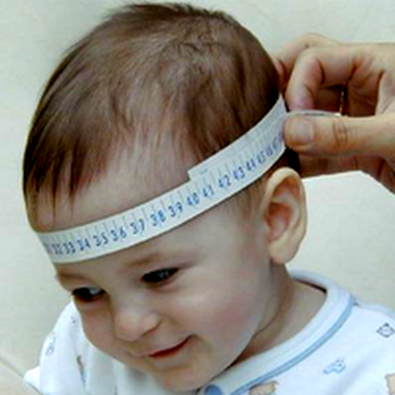 HYDROCEPHALUS (Pediatrics)