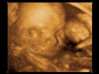 [BABY 20 WEEKS_2[7].jpg]