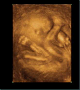 BABY 20 WEEKS_4
