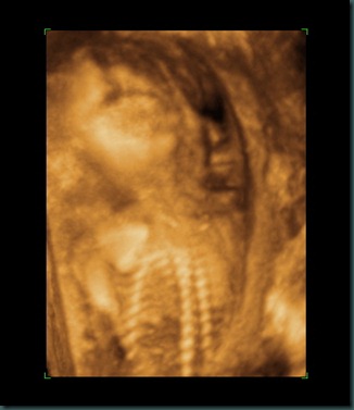 BABY 20 WEEKS_5