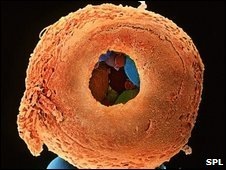 [_45314113_p680400-coloured_sem_of_8-cell_human_embryo_drilled_open-spl-2[7].jpg]