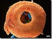 _45314113_p680400-coloured_sem_of_8-cell_human_embryo_drilled_open-spl-2