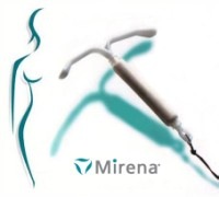 Mirena-IUD