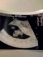 Baby Wiles first picture (8 weeks, 3 days)