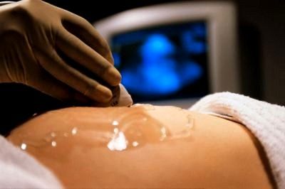 Ultrasound Scanning Ultrasound Scanning