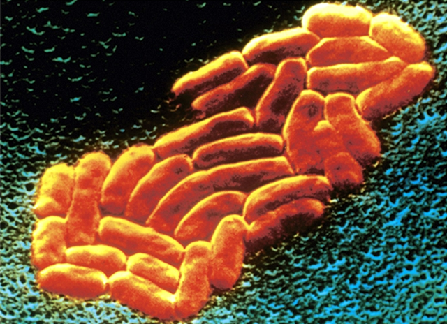Photomicrograph of Klebsiella pneumoniae bacteria depicting rod-shape morphology. ppdictionary.com