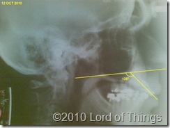 LateralEncephalogram-Oct2010