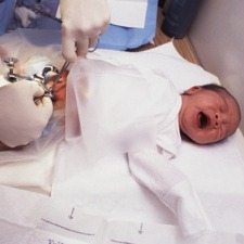 [circumcision[2].jpg]