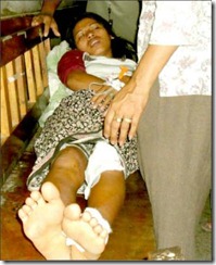 manipur attack victim