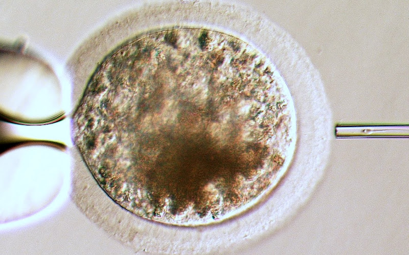 Intra-Cytoplasmic Sperm Injection (ICSI)