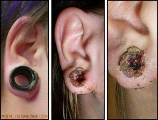 [Imagem: Piercings%26alargadores%20(8).jpg]