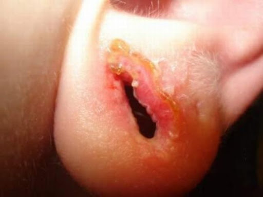 Piercings e Alargadores
