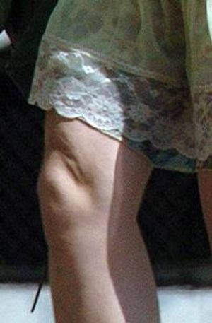 Imperfeições das Celebridades