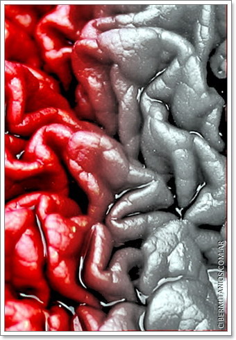cerebros