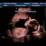 2010_03 Ultrasound 4.jpg