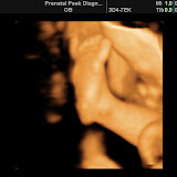 BABY_17.JPG