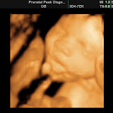 BABY_8.JPG