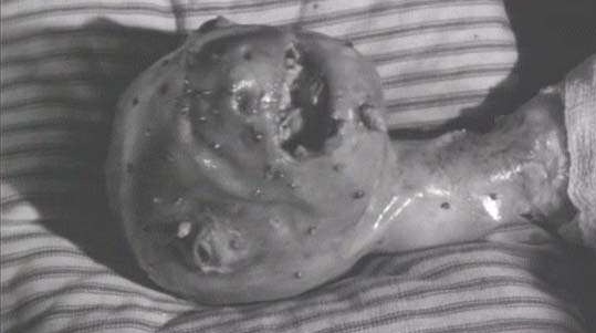 [eraserhead 02[4].jpg]