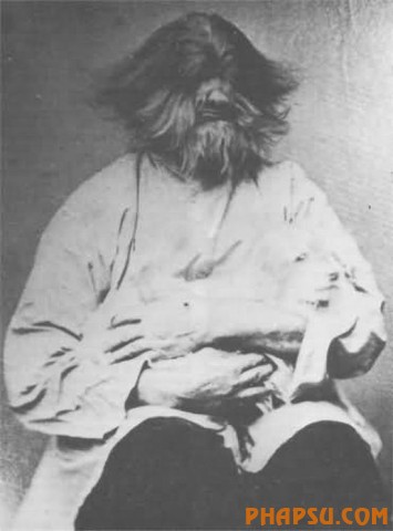 deformities_10.jpg?imgmax=576
