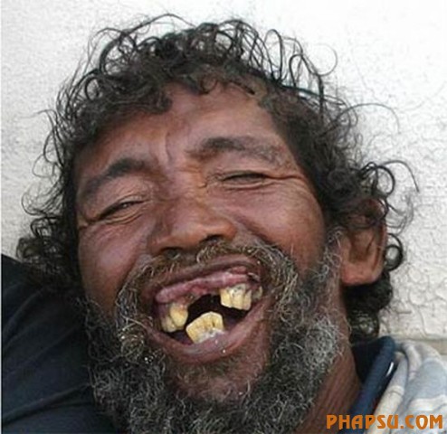 deformities_19.jpg?imgmax=576