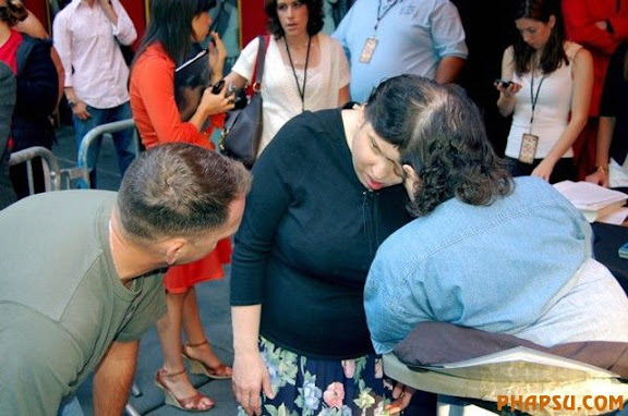 deformities_28.jpg?imgmax=576