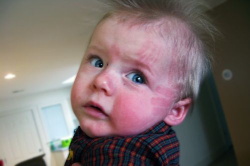 Abuse Marks