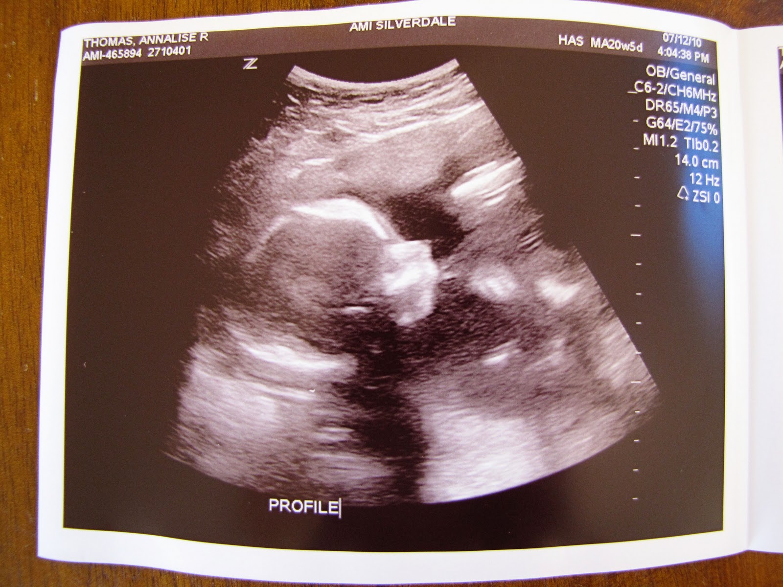 baby boy 2's 20 weeks ultrasound! Sweet Anna's