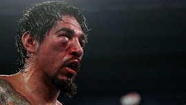 Margarito fractura en la cara