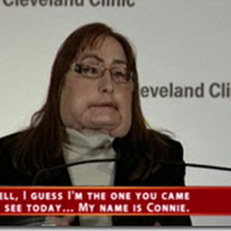 First U.S. Face Transplant Patient Talks on Camera from the Cleveland Clinic