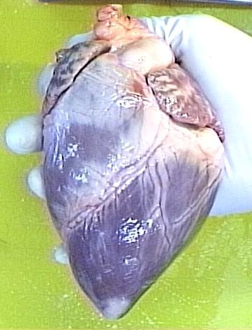[intact_ventricles[2].jpg]