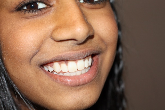 [braces 0014_resize[4].jpg]