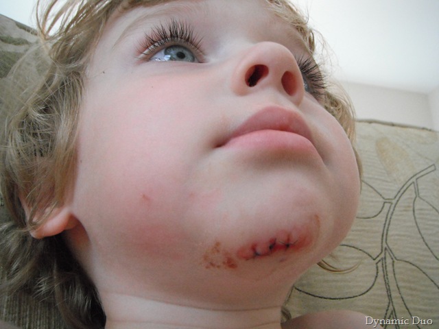 [the chin day two![8].jpg]