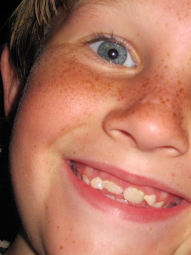 blake