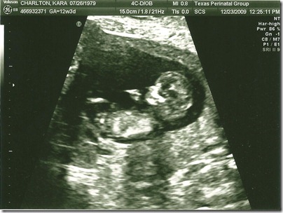 sonogram2