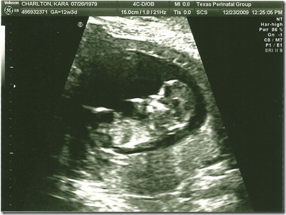 sonogram3