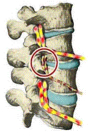 [chiro-subluxation-normal-nerve-flow[3].gif]