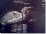 20wks3 days